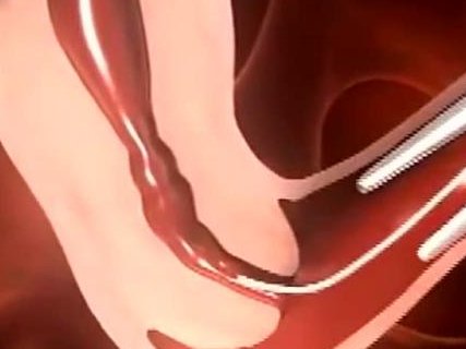 泰国试管婴儿一共花多少钱？全程费用大公开